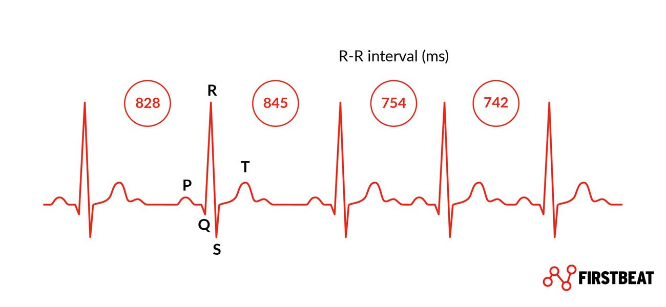 Waarom je hart sneller klopt bij een lage HRV Image